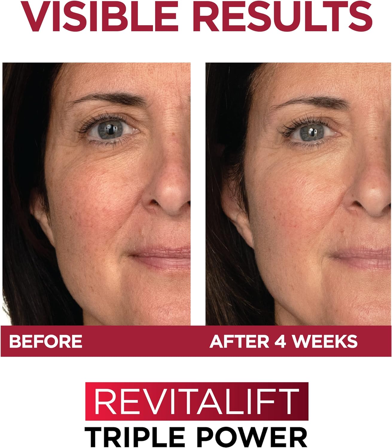 L'Oreal Paris Revitalift Triple Power Anti-Aging Face Moisturizer, Pro Retinol, Hyaluronic Acid & Vitamin C, Reduce Wrinkles 2.55 Oz