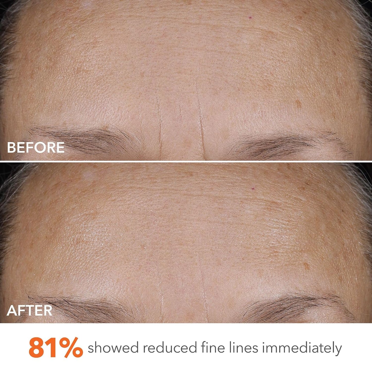 Dr Dennis Gross DermInfusions Blur + Repair Cream, Instantly Blurs Fine Lines, Smooths Skin with Satin-Matte Finish, Visibly Plumps & Firms, Reduces Redness, and Improves Skin Elasticity, 1.7 Fl Oz