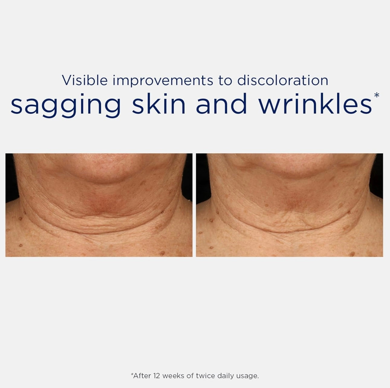 NEOSTRATA Skin Active Triple Firming Neck Cream, Anti-Aging Moisturizer with MicroDiPeptide229 to Tighten and Smooth Wrinkles Neck & Décolletage, Fragrance Free, For all Skin Types, 80g-USA made