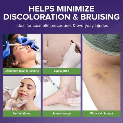 BIOCORNEUM Advanced Bruise Dietary Supplement – Internal Support for Visible Bruise Recovery