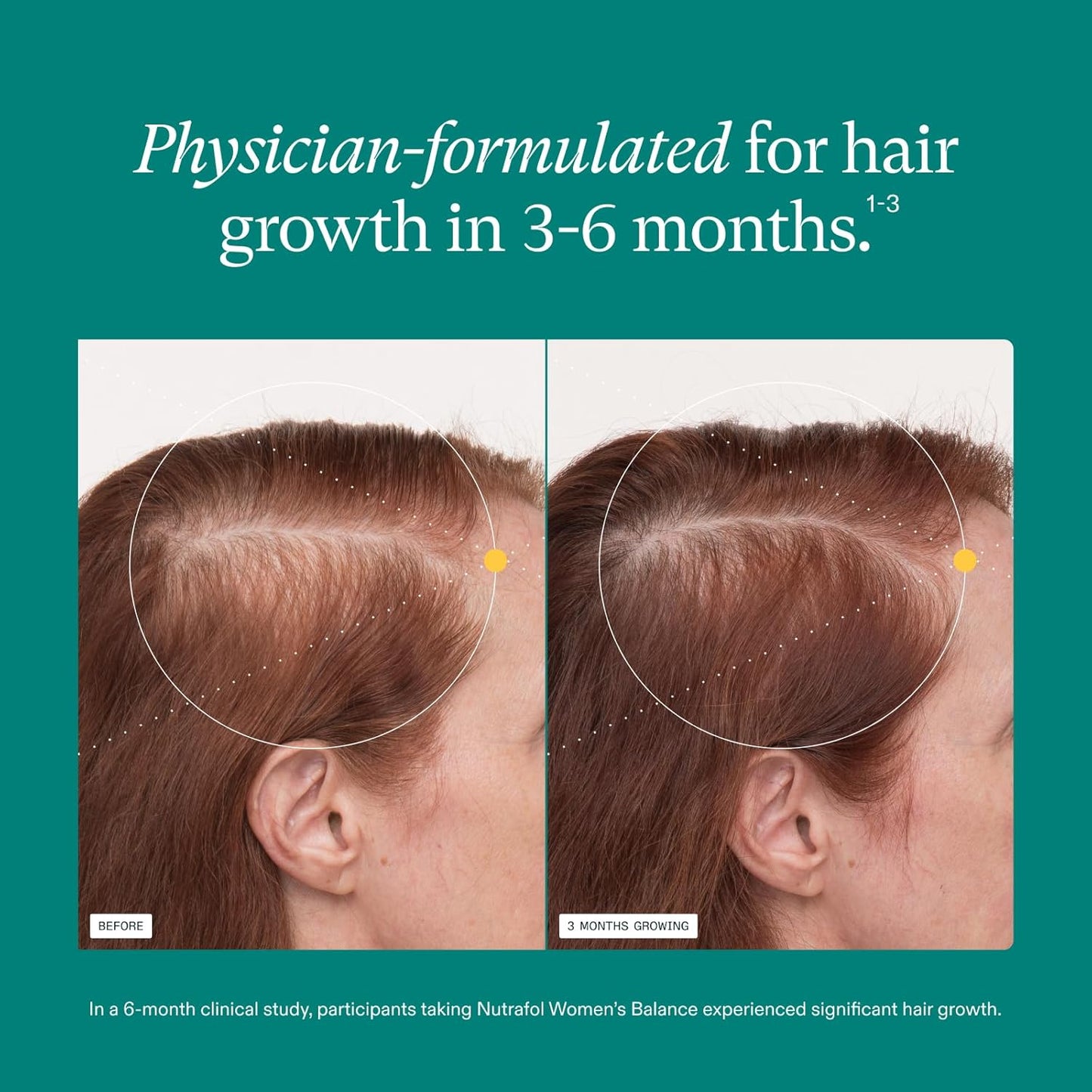 Nutrafol Women's Balance Hair Growth Supplements, Ages 45 and Up, Clinically Proven