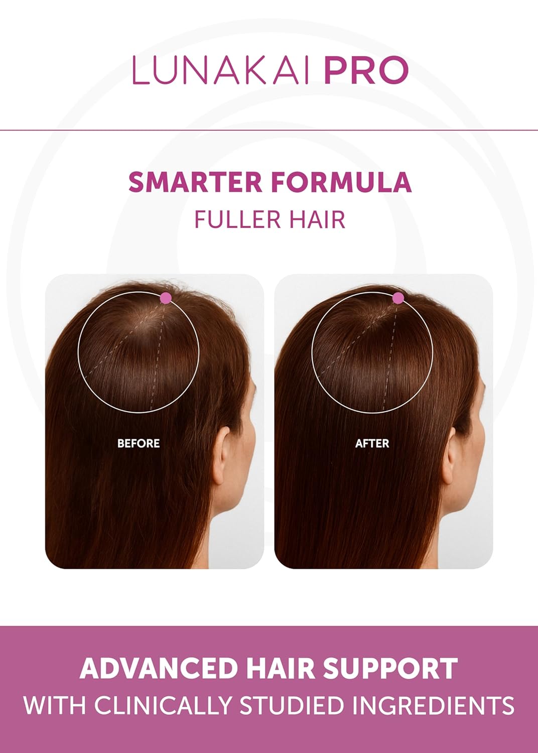 Lunakai PRO USA Made Women’s Hair Growth & Restore Vitamins