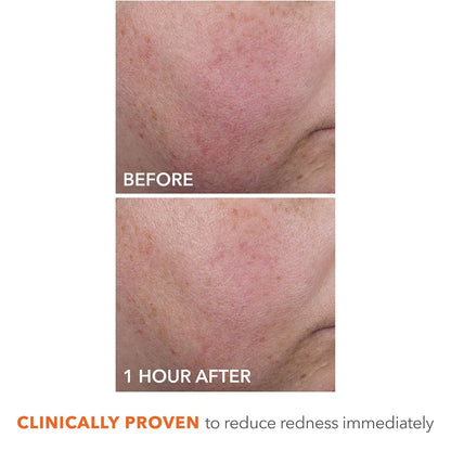 Dr Dennis Gross DermInfusions Blur + Repair Cream, Instantly Blurs Fine Lines, Smooths Skin with Satin-Matte Finish, Visibly Plumps & Firms, Reduces Redness, and Improves Skin Elasticity, 1.7 Fl Oz
