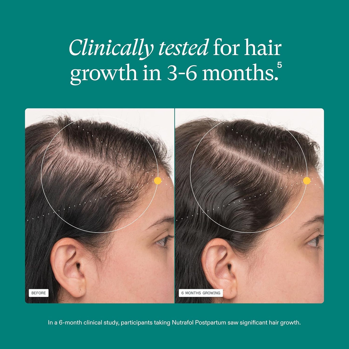 Nutrafol Postpartum Hair Growth Supplements, Clinically Tested for Visibly Thicker Hair