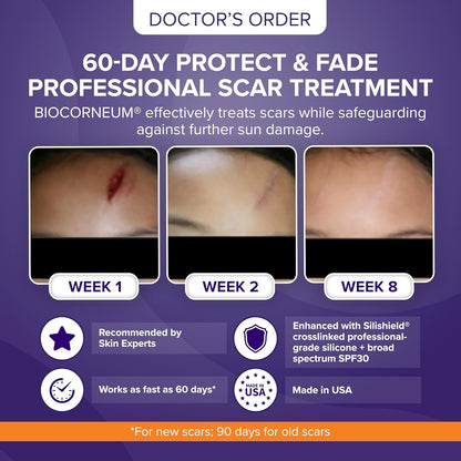 Advanced Scar Treatment with Silishield® & SPF 30 50g – Made in the USA